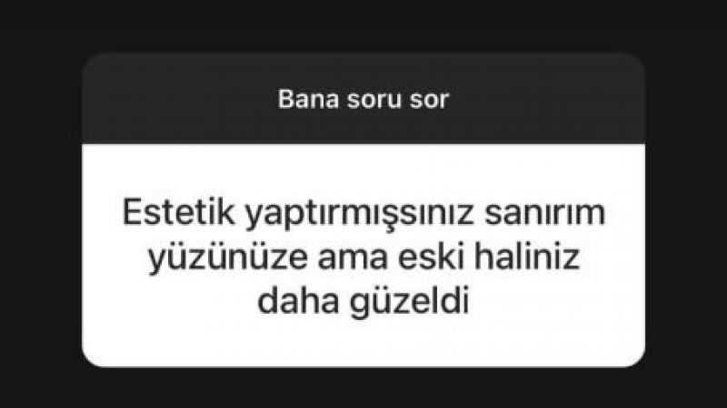 Takipçisi Sordu, Esra Ezmeci Yanıtladı: Ünlü Psikolog Estetik İddialarına Son Noktayı Koydu! 2