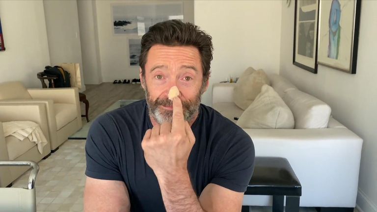 Hugh Jackman sağlık durumunu açıkladı! Ünlü aktör ikinci kez… 2