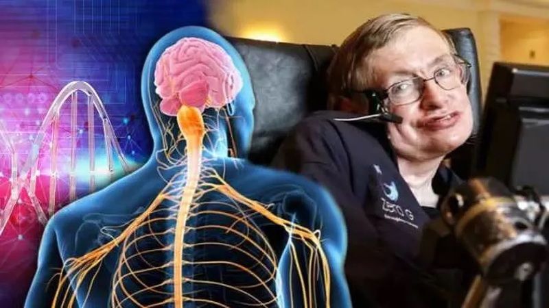 Stephan Hawking’in Senelerce Mücadelesini Verdiği ALS Hastalığı Nedir? ALS Nasıl Ortaya Çıkar? 2