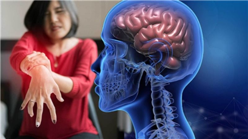 Bu Belirtilere Dikkat! Parkinson Hastalığının 10 Sene Önce Bu Belirtiler İle İşaret Verdiği Ortaya Çıktı! 2