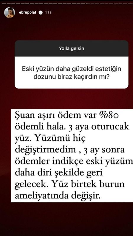 Hayranından Ebru Polat'a Ağır Eleştiri: “Eski Yüzün Daha İyiydi, Estetiğin Dozunu Kaçırmışsın!” 3