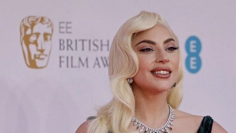 Lady Gaga rahatsızlık mı geçirdi? Midesinden 5 litre sperm çıktı iddiası sosyal medyayı salladı... 4