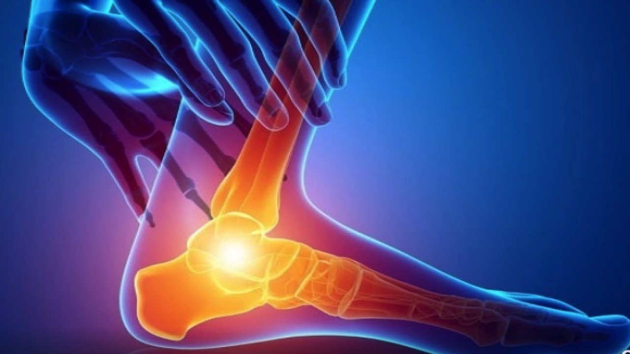 Plantar Fasiit Belirtileri Nedir? | Op. Dr. Utku Erdem Özer