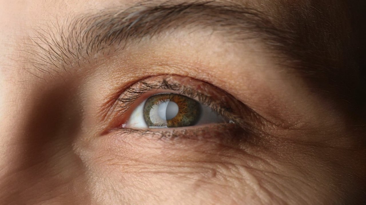 Göz Sağlığı Uzmanı Doç. Dr. Aylin Kılıç