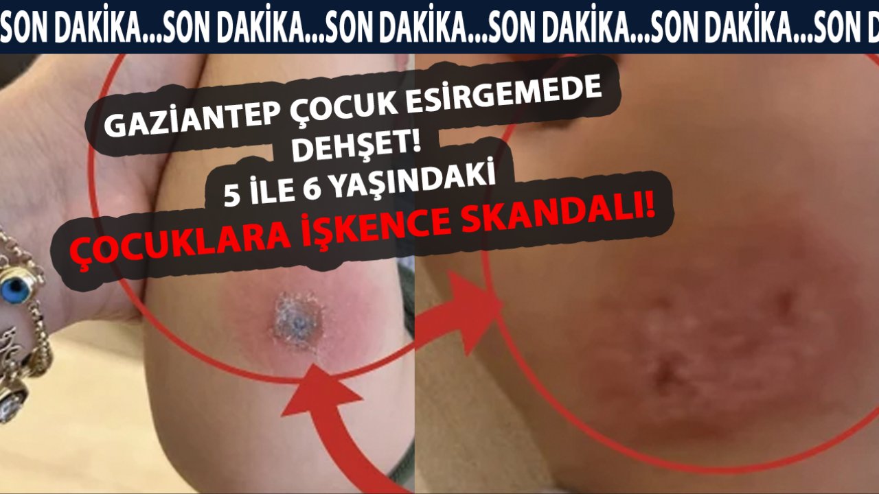 Gaziantep Çocuk Esirgemede DEHŞET! 5 ile 6 Yaşındaki Çocuklara İşkence SKANDALI!