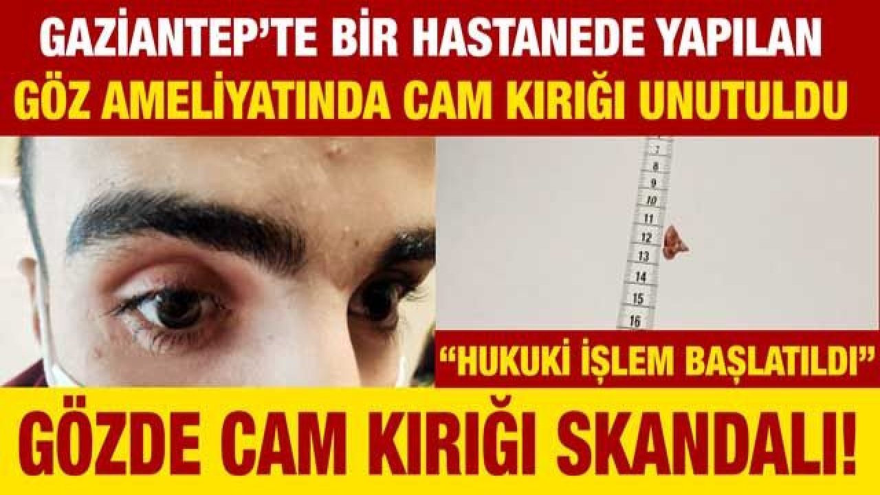 Gözde cam kırığı skandalı!... Gaziantep’te bir hastanede yapılan göz ameliyatında cam kırığı unutuldu