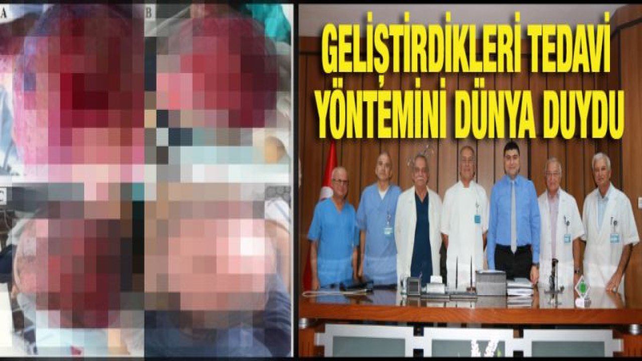 25 ARALIK DEVLET HASTANESİ YANIK MERKEZİ BİR İLK BAŞARDI!