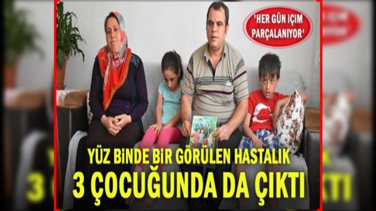 Yüz binde bir görülen hastalık 3 çocuğunda da çıktı