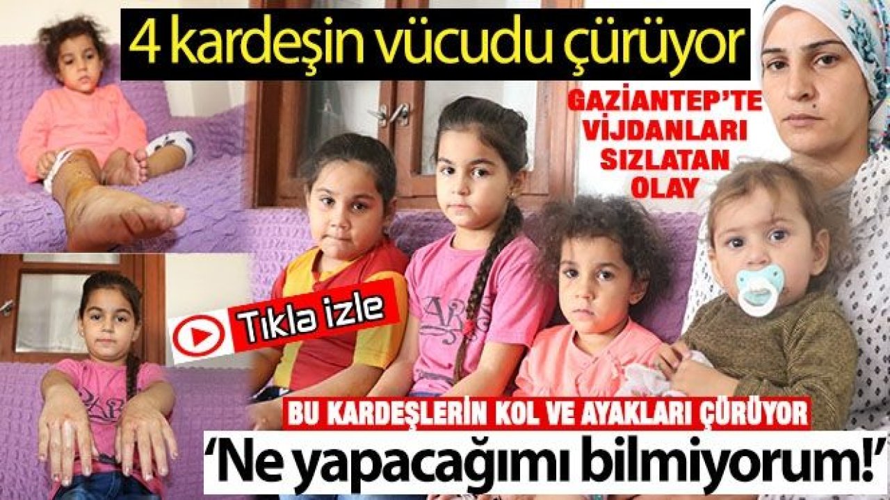 Video İzle...Gaziantep'te 4 Küçük Kardeşin Yardım Feryadı...Bu kardeşlerin kol ve ayakları çürüyor