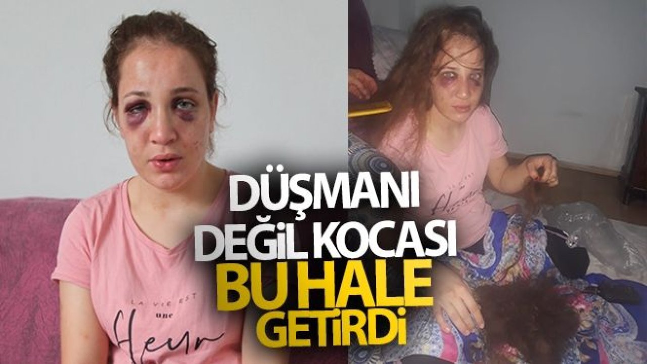 3 çocuk annesi Özlem'i düşmanı değil kocası bu hale getirdi