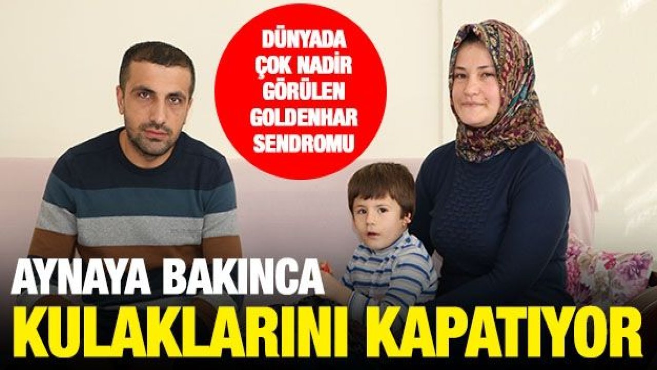 Aynaya bakınca kulaklarını kapatıyor