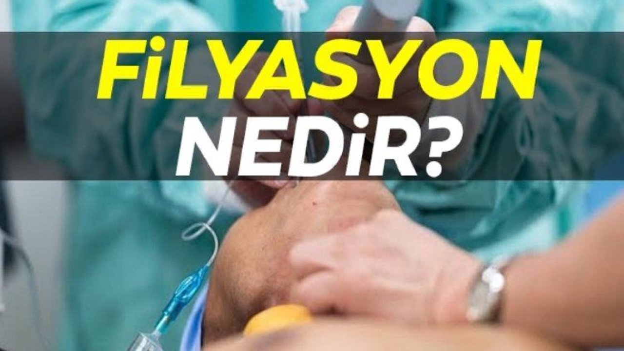 Filyasyon ne demek?