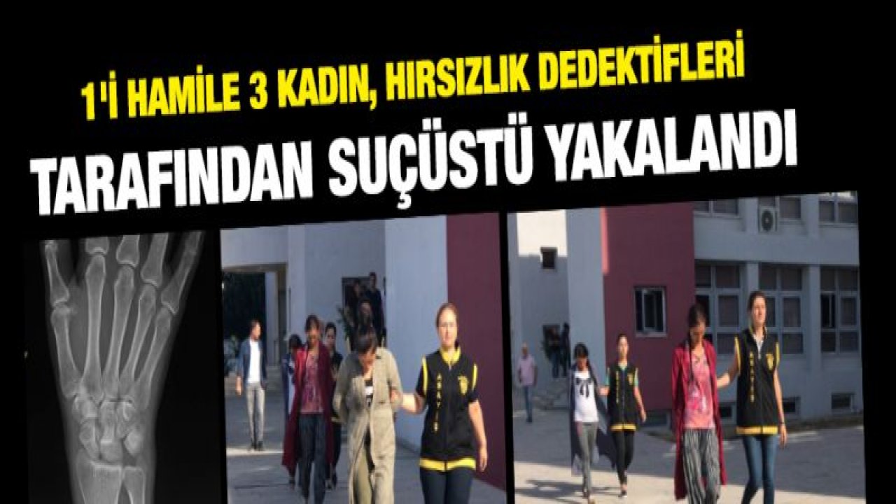 Röntgen filmiyle şehirler arası soygun