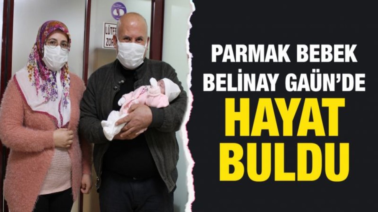 Parmak bebek Belinay GAÜN Hastanesinde hayat buldu