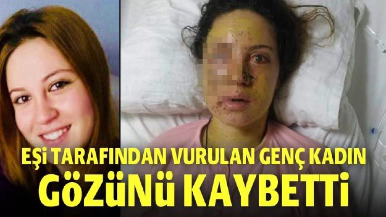 Eşi tarafından vurulan genç kadın gözünü kaybetti