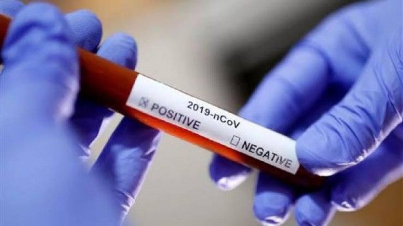 Covid-19 PCR Testleri neden şehir içinde geziyor?