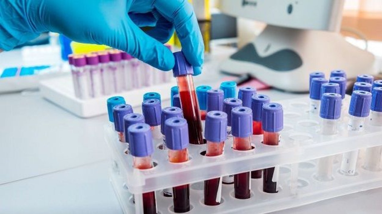 Hiv testi nedir, nasıl yapılır?