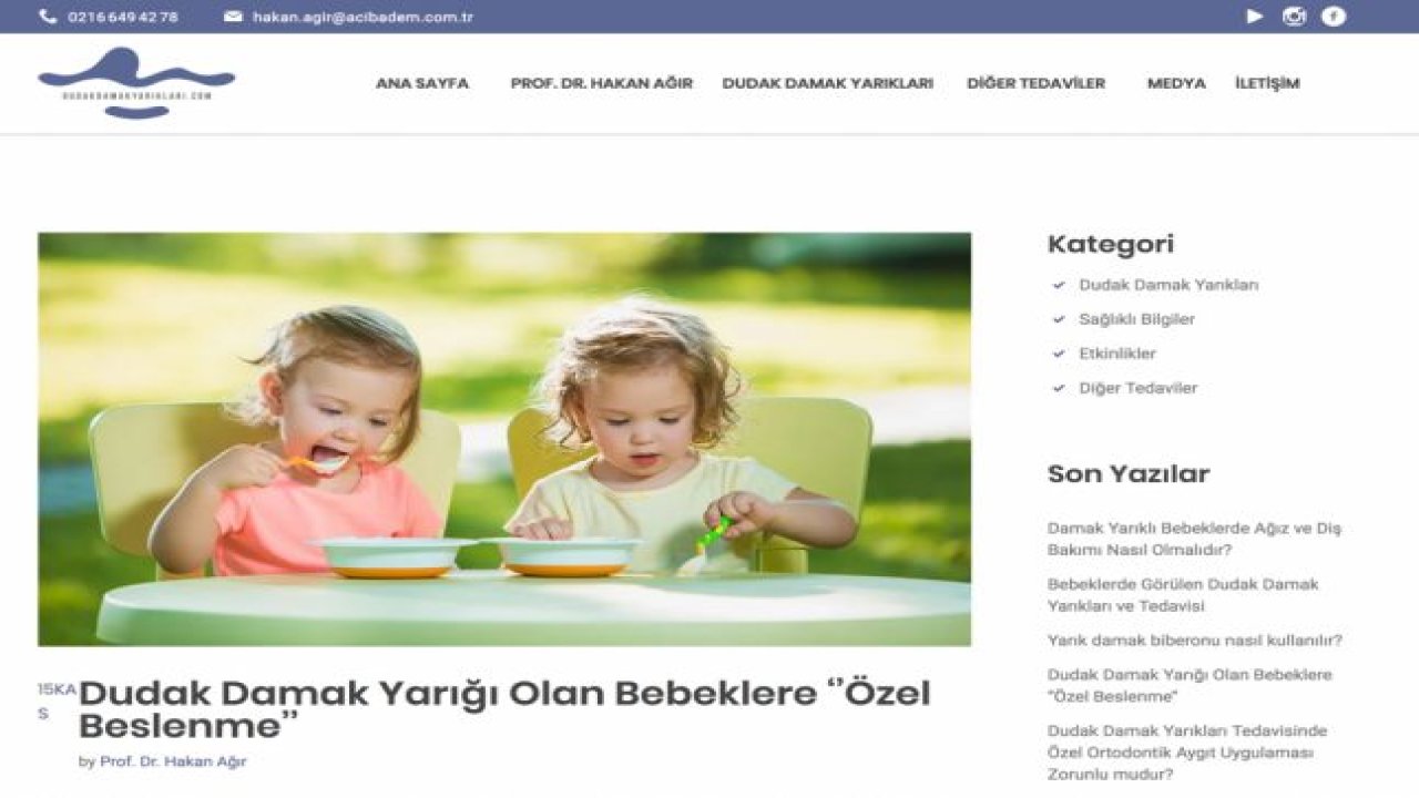 Dudak Damak Yarığı Olan Bebeklere ‘’Özel Beslenme’’