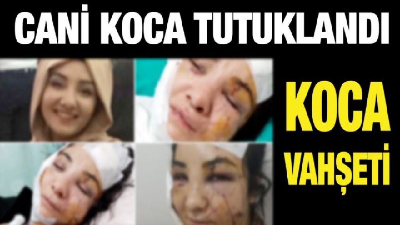 Gaziantep'te Koca vahşeti...Defalarca Eşini Bıçakladı