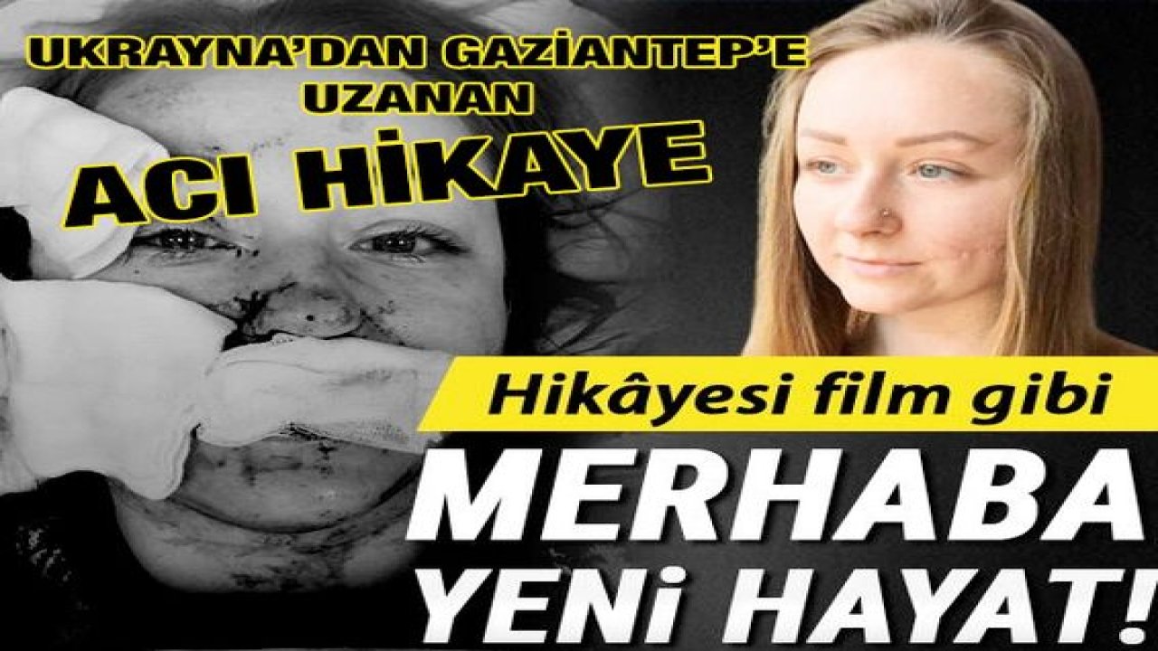 Boşanmak İstedi..Yüzü Falçatayla Kesildi...Ukrayna'dan Gaziantep'e Uzanan Acı Hikaye