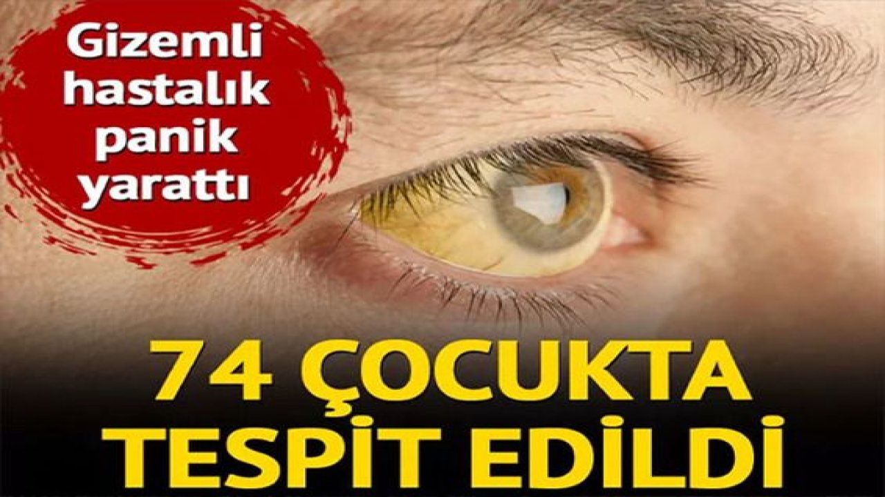 Gizemli hastalık panik yaratıyor! 74 çocukta tespit edildi