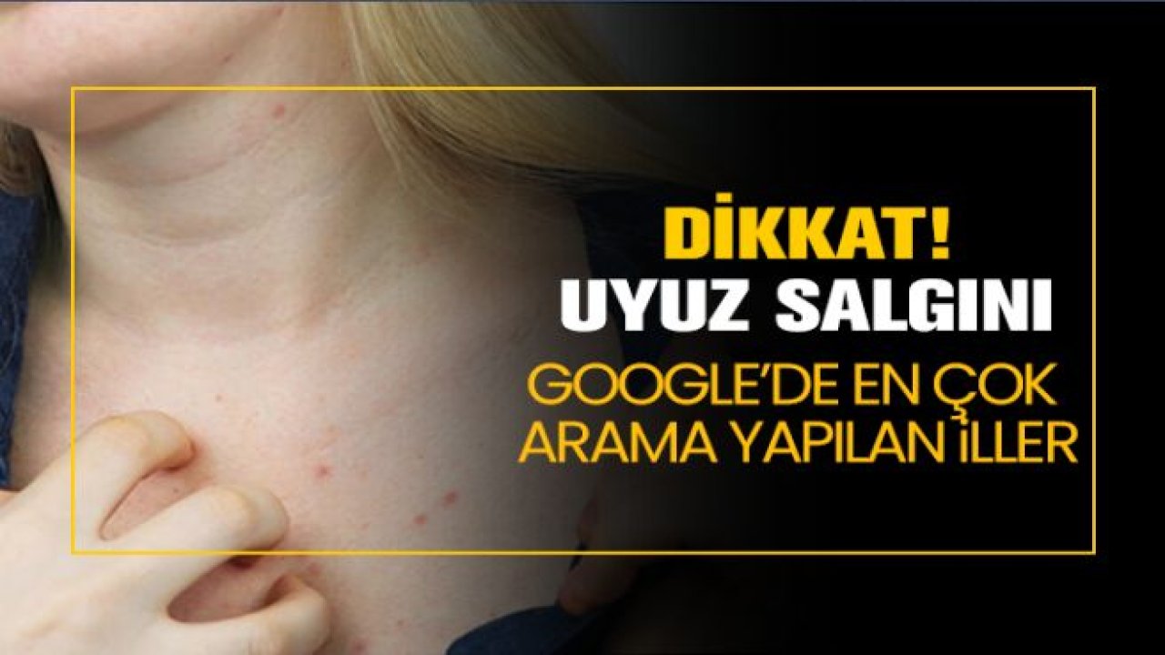 Uyuz salgını "Google’de en çok arama yapılan iller"