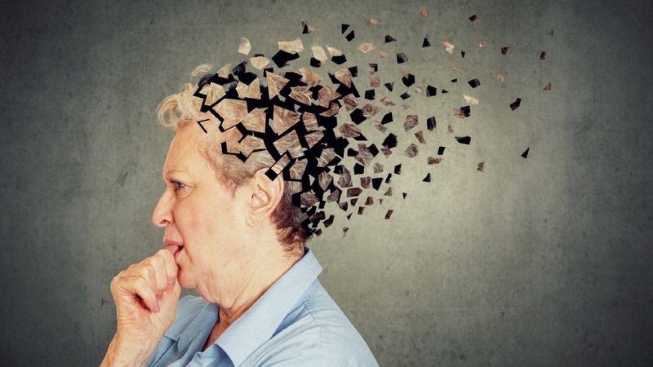 Türkiye Alzheimer hastalığının en sık görüldüğü 4. ülke! Hastalığın belirtileri nelerdir?