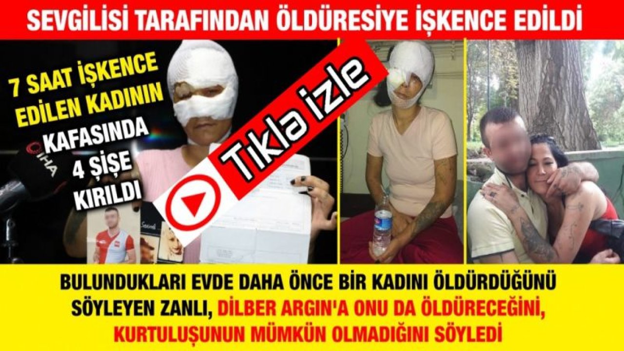 Gaziantep'te Sevgilisi tarafından öldüresiye işkence edildi