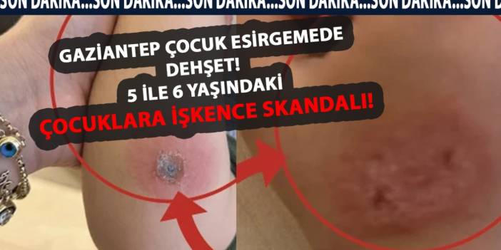 Gaziantep Çocuk Esirgemede DEHŞET! 5 ile 6 Yaşındaki Çocuklara İşkence SKANDALI!