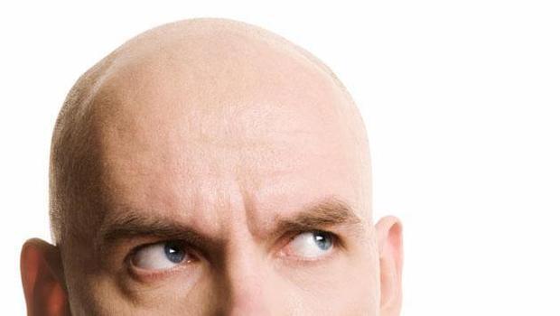 alopesi-nedir-kellik-nedir-1.jpg